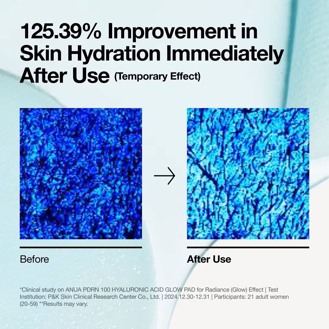 Anua - PDRN 100 Hyaluronic Acid Glow Pad 180ml (60EA)
