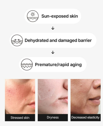 IUNIK - Beta-Glucan Barrier Sunscreen: Ultimate Daily UV Protection & Hydration