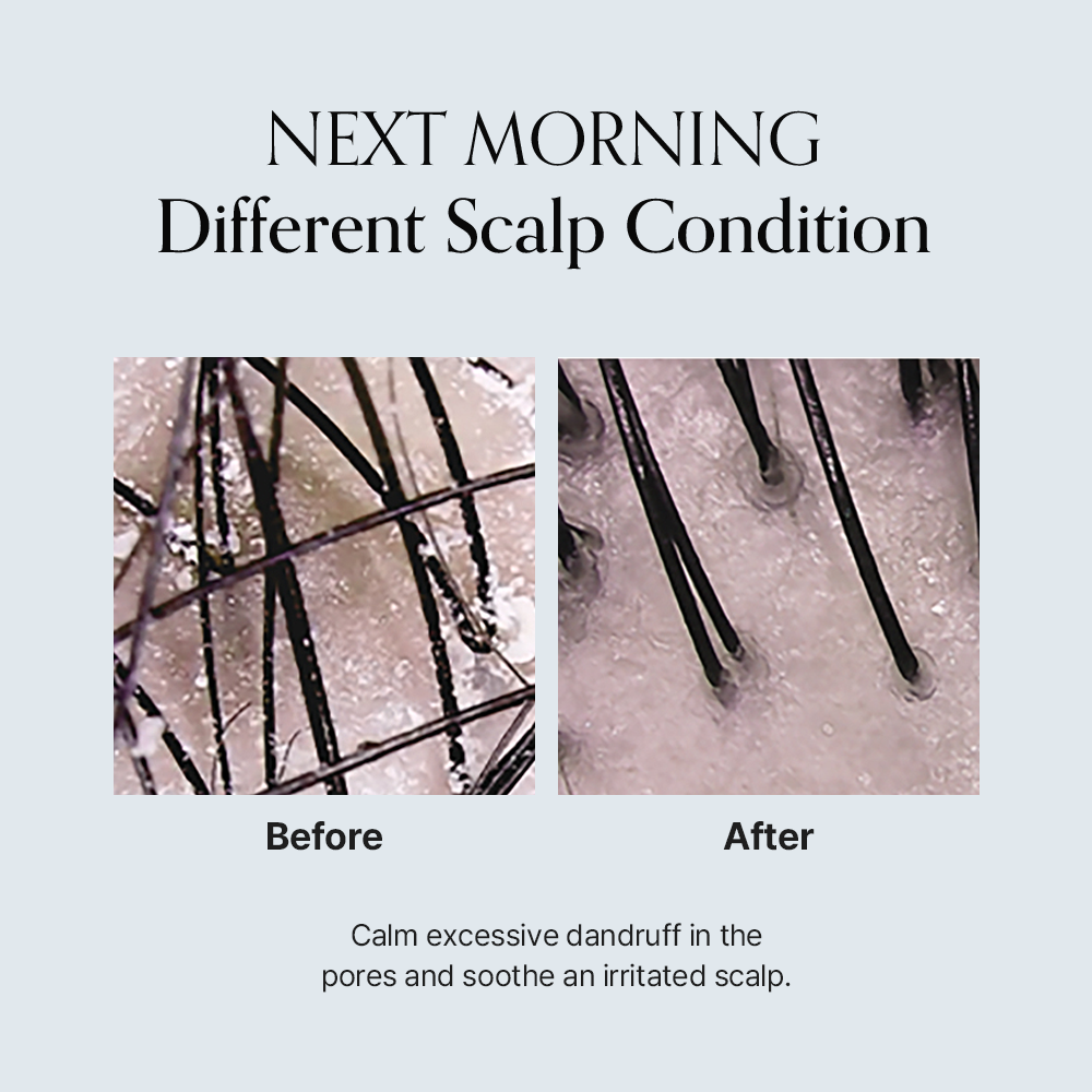 Damage Therapy Scalp Ampoule (50ml / 1.69 fl.oz.)