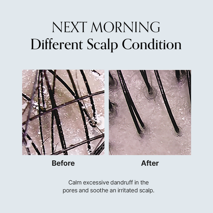 Damage Therapy Scalp Ampoule (50ml / 1.69 fl.oz.)