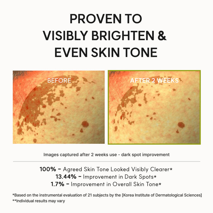 https://cdn.shopify.com/s/files/1/0592/7400/2585/files/06_45ed0c9d-b298-4e9f-b6f0-9e474c347422.jpg?v=1778032131