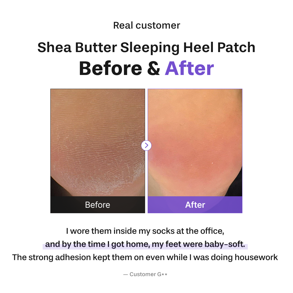 Shea Butter Sleeping Heel Patch, 10pcs