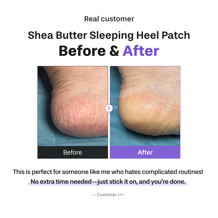 Shea Butter Sleeping Heel Patch, 10pcs