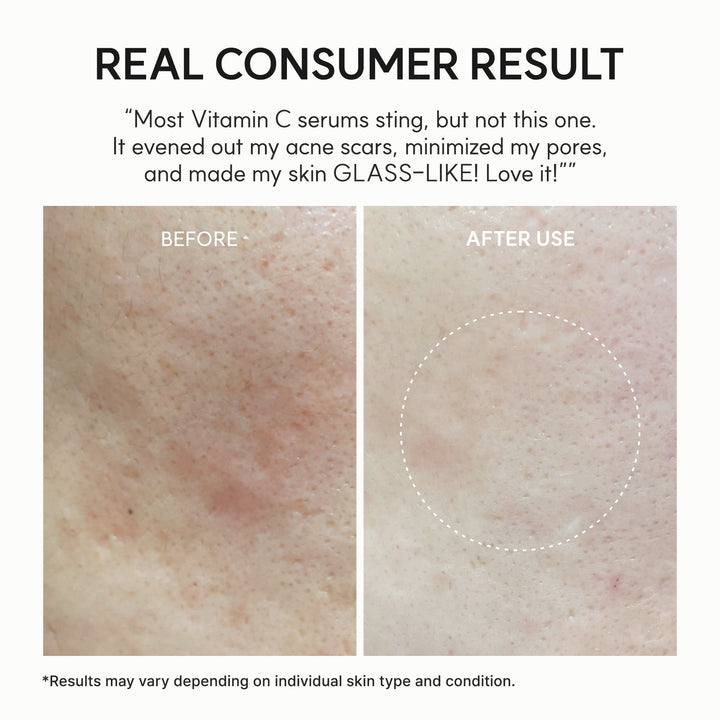 https://cdn.shopify.com/s/files/1/0592/7400/2585/files/07_d292213d-6de0-49f9-9c5d-9bdcef61bc3e.jpg?v=1778032131