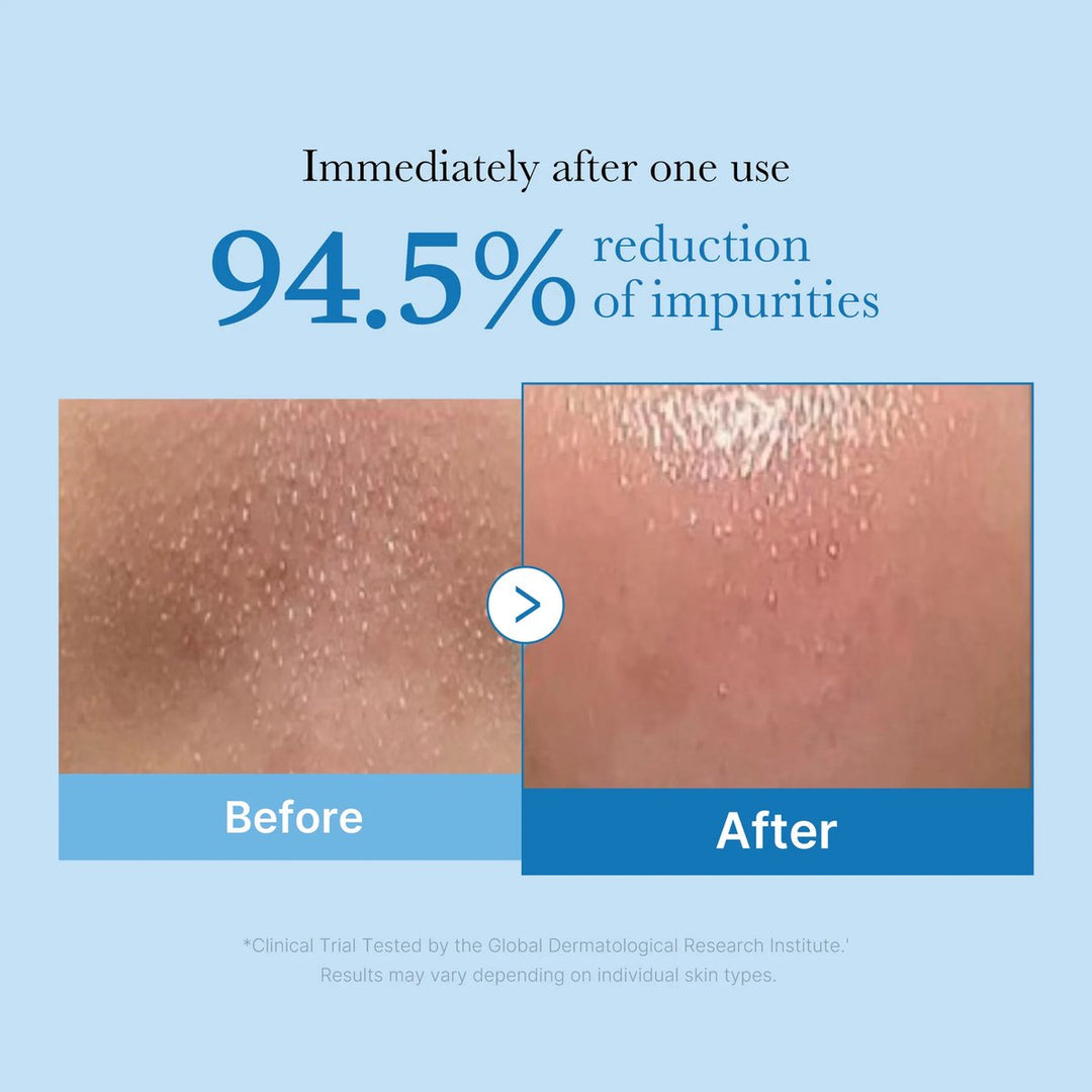 Medicube - ZERO PORE BLACKHEAD DEEP CLEANSING OIL 205ml