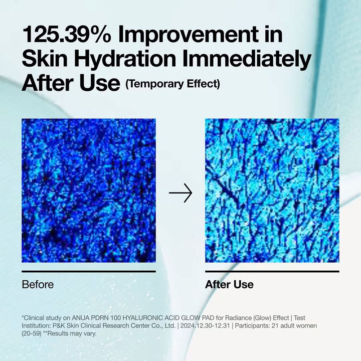 Anua - PDRN 100 Hyaluronic Acid Glow Pad 180ml (60EA)