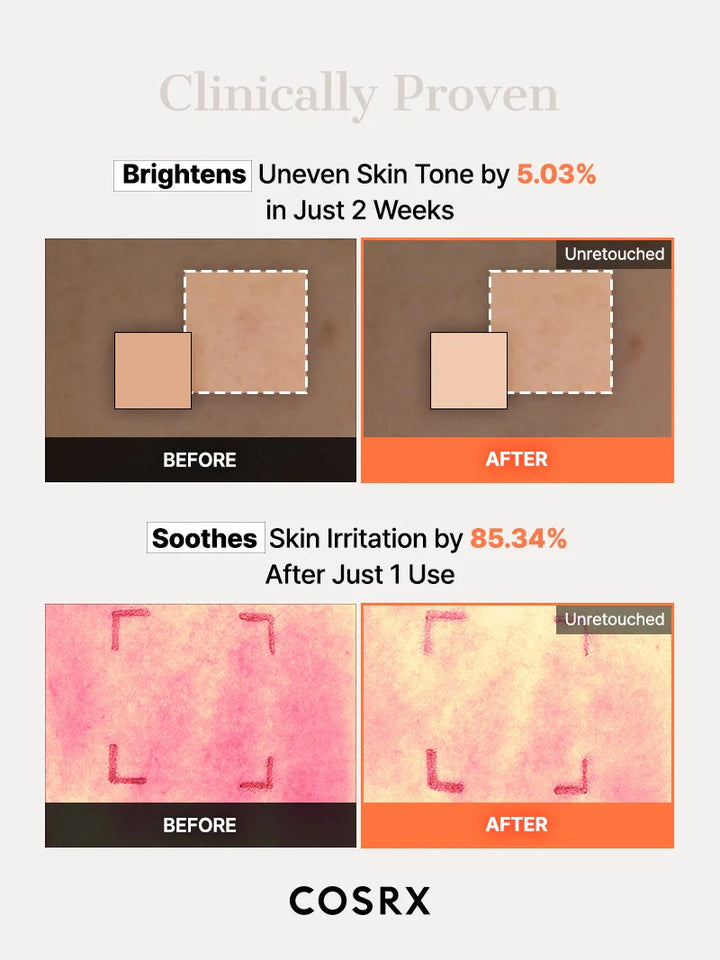 https://cdn.shopify.com/s/files/1/0513/3775/6828/files/5PDRN_Hydrogel_Mask_12.webp?v=1761901173
