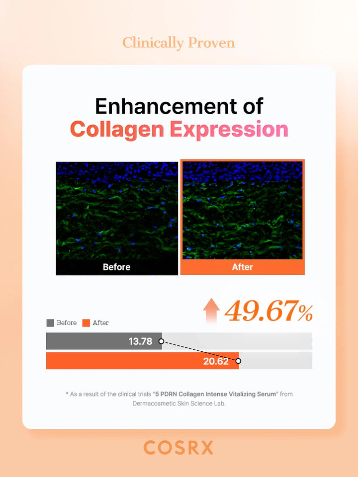 https://cdn.shopify.com/s/files/1/0513/3775/6828/files/5PDRN_Serum_08__2_1.webp?v=1762906527