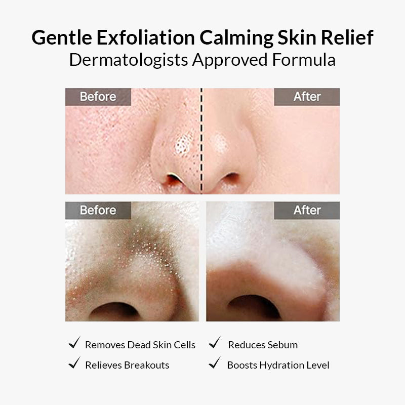 Celimax Ji Woo Gae Heartleaf BHA Peeling Pads – 60 Dual‑Sided
