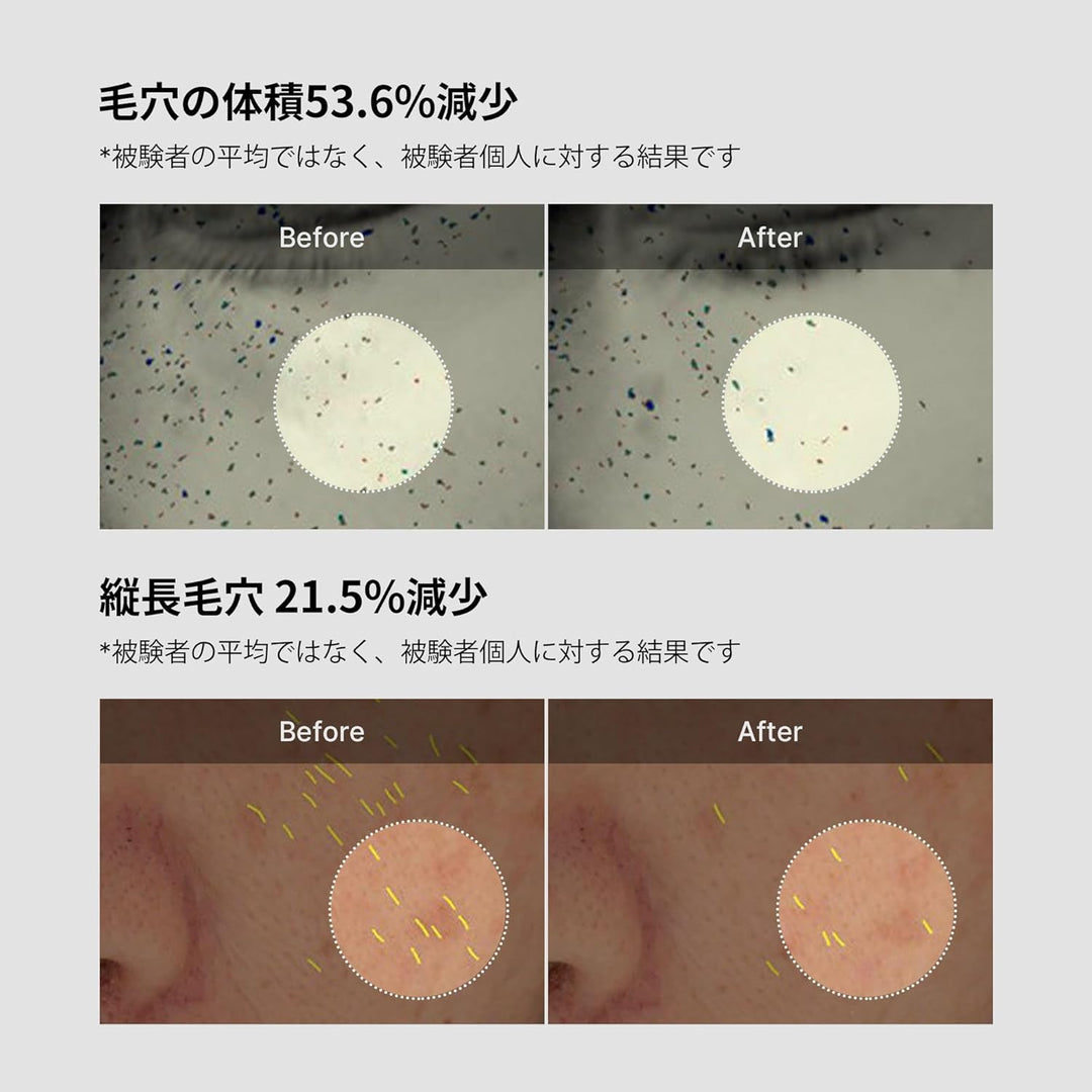 Medicube - Zero Pore One Day Cream - 50 ml