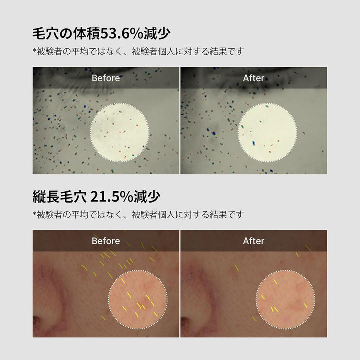 Medicube - Zero Pore One Day Cream - 50 ml