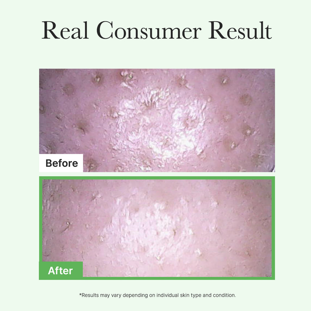 Pore Melt Mochi  Makeup-Removing Cleansing Oil, Non-Comedogenic, Acne-Safe, Rice Amino Acids HD, Vitamin E, Cica, & Ceramide, 6.76 fl oz