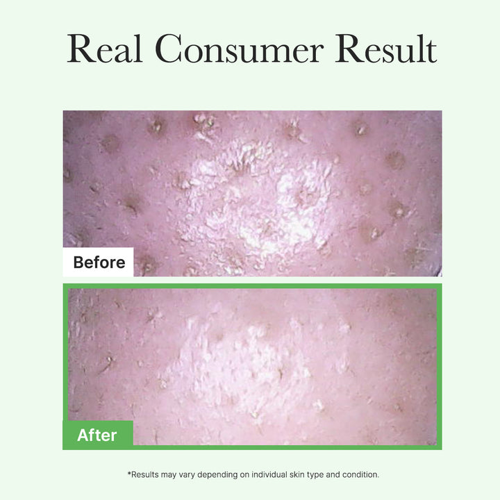 Pore Melt Mochi  Makeup-Removing Cleansing Oil, Non-Comedogenic, Acne-Safe, Rice Amino Acids HD, Vitamin E, Cica, & Ceramide, 6.76 fl oz
