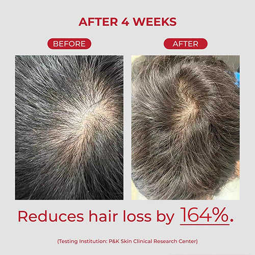Annurcatin Shampoo 525ml