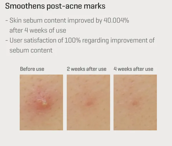 SOME BY MI- Sérum Réactivateur Intense Rétinol- 30ml