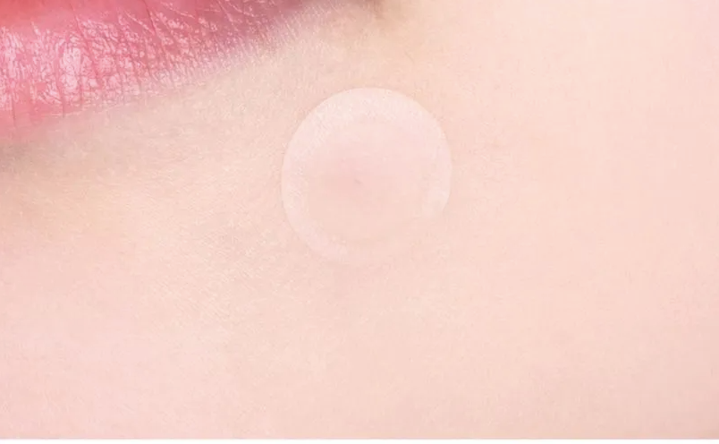 VT- Patchs anti-boutons Cica Spot Patch