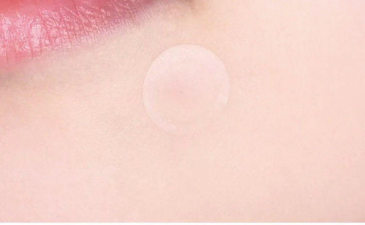 VT- Patchs anti-boutons Cica Spot Patch