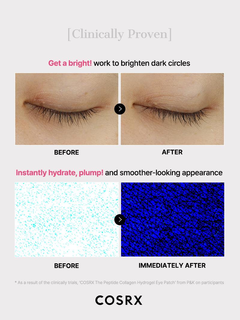 https://cdn.shopify.com/s/files/1/0513/3775/6828/files/Hydrogel_Eye_patch_8.jpg?v=1768284034
