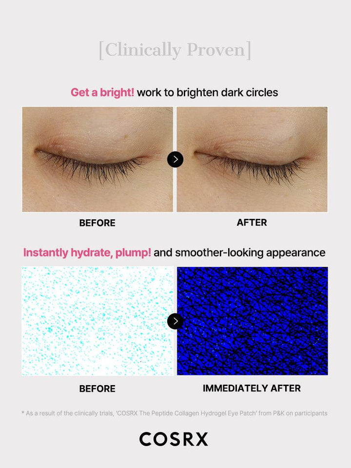 https://cdn.shopify.com/s/files/1/0513/3775/6828/files/Hydrogel_Eye_patch_8.jpg?v=1768284034