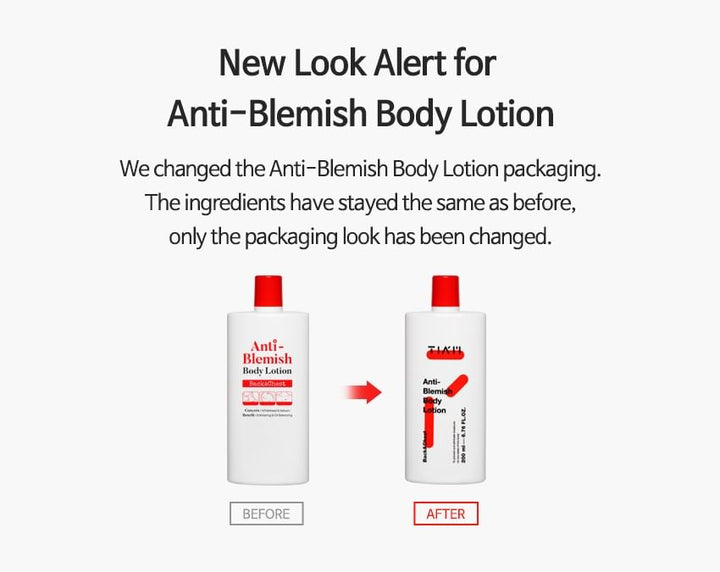 TIA'M Anti-Blemish Body Lotion: Back & Chest Renewal Formula for Clear Skin