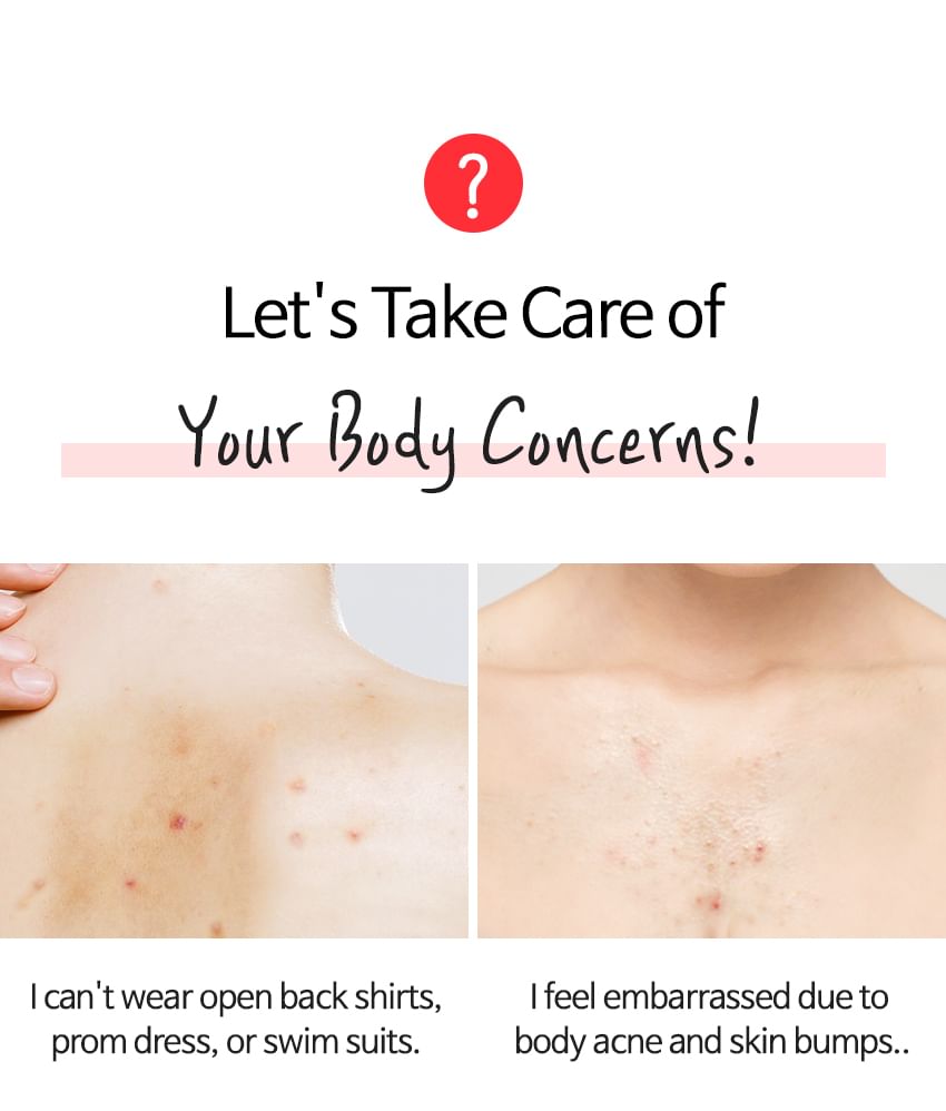 TIA'M Anti-Blemish Body Lotion: Back & Chest Renewal Formula for Clear Skin