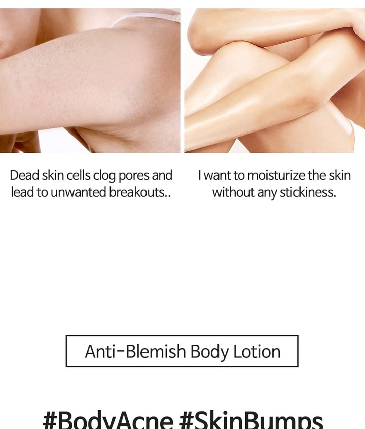 TIA'M Anti-Blemish Body Lotion: Back & Chest Renewal Formula for Clear Skin