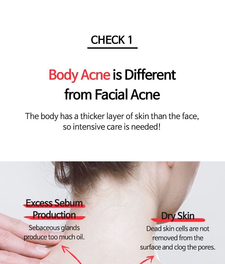 TIA'M Anti-Blemish Body Lotion: Back & Chest Renewal Formula for Clear Skin