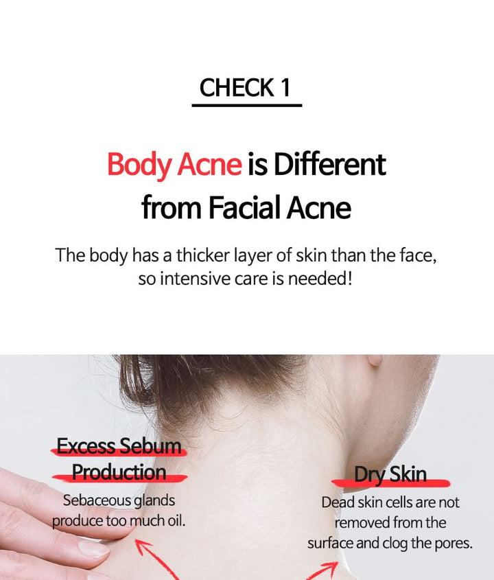 TIA'M Anti-Blemish Body Lotion: Back & Chest Renewal Formula for Clear Skin