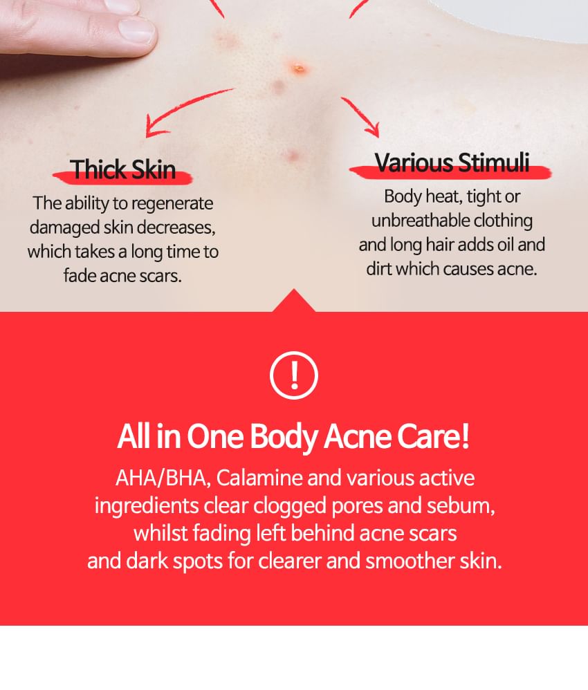 TIA'M Anti-Blemish Body Lotion: Back & Chest Renewal Formula for Clear Skin