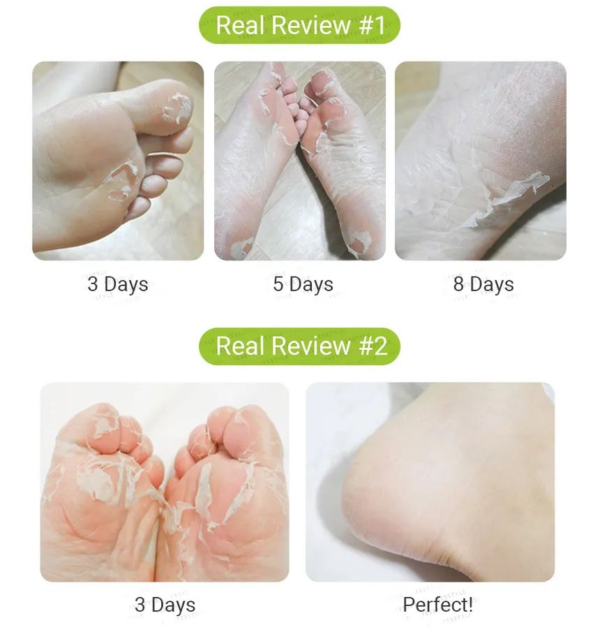 Purederm Advanced Exfoliating Foot Peeling Mask for Silky Soft Feet, 1 Pair