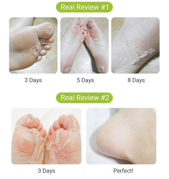 Purederm Advanced Exfoliating Foot Peeling Mask for Silky Soft Feet, 1 Pair