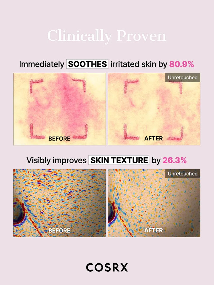 https://cdn.shopify.com/s/files/1/0513/3775/6828/files/Peptide_Hydrogel_Mask_12.webp?v=1746780161