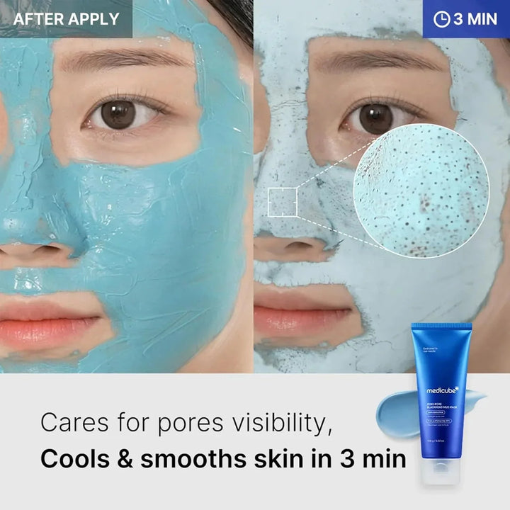 Medicube - Zero Pore Blackhead Mud Mask - Purifying Face Mask with Clay - 100g