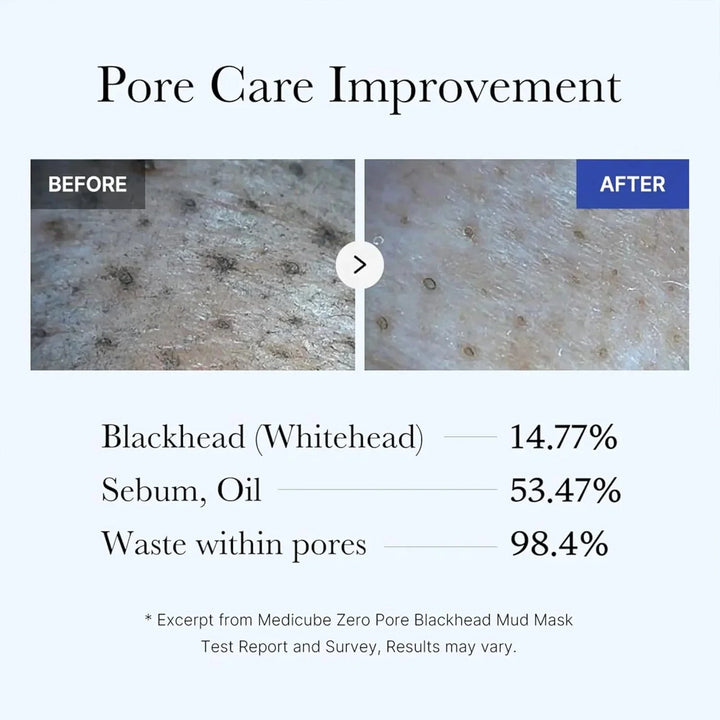 Medicube - Zero Pore Blackhead Mud Mask - Purifying Face Mask with Clay - 100g