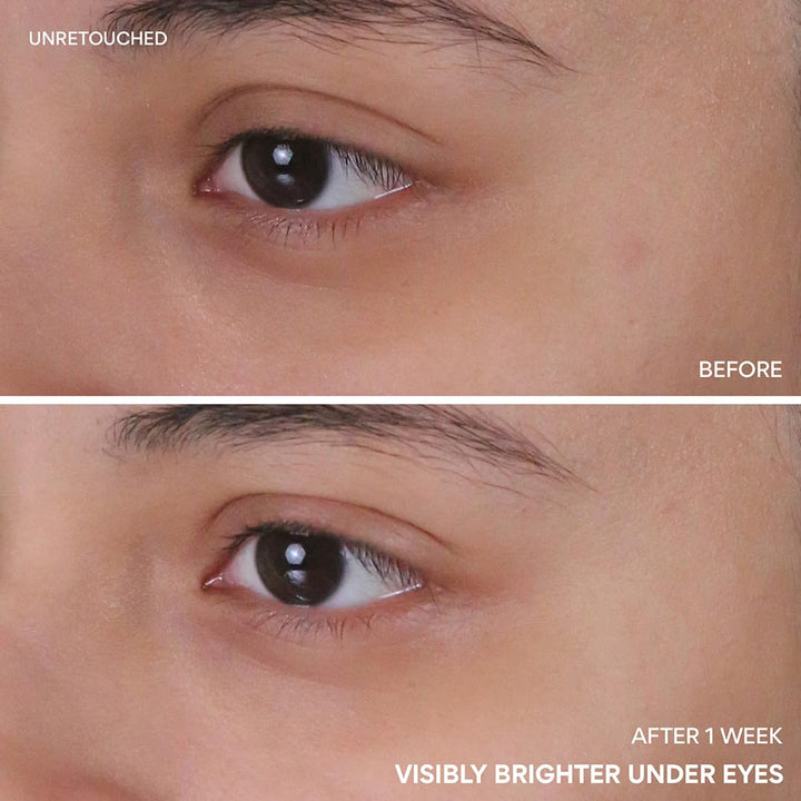 INNISFREE – Vitamin C Niacinamide Brightening Eye Serum