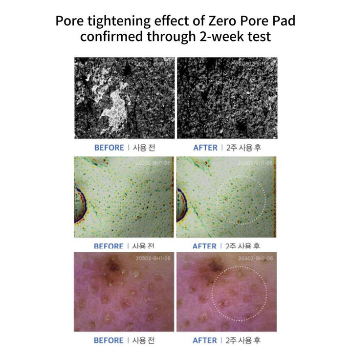 Medicube - zero pore pad mild – 70 pièces
